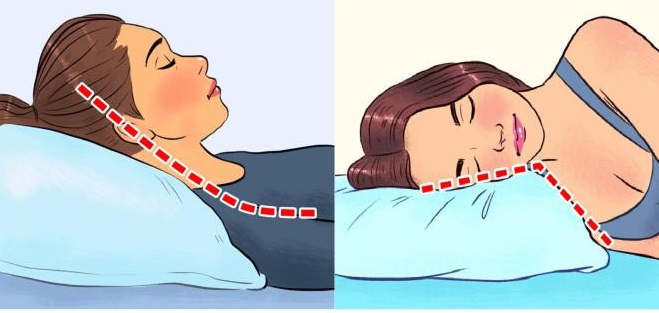 Hay gối cao đầu khi ngủ là một trong những thói quen xấu gây thiếu máu não