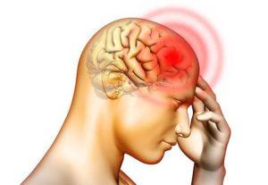 17 cách trị đau nửa đầu tại nhà hiệu quả không dùng thuốc